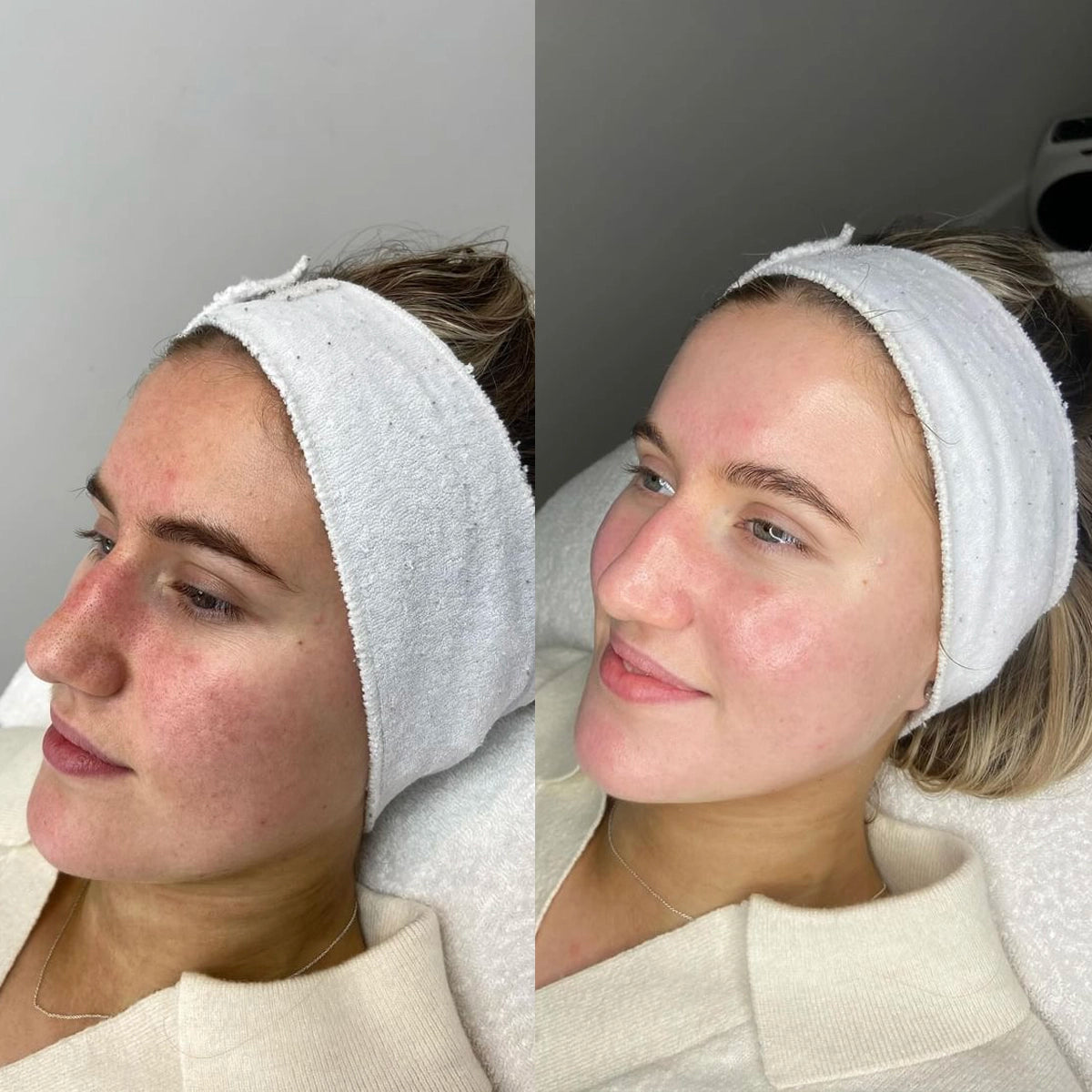 Pre & Post Procedure