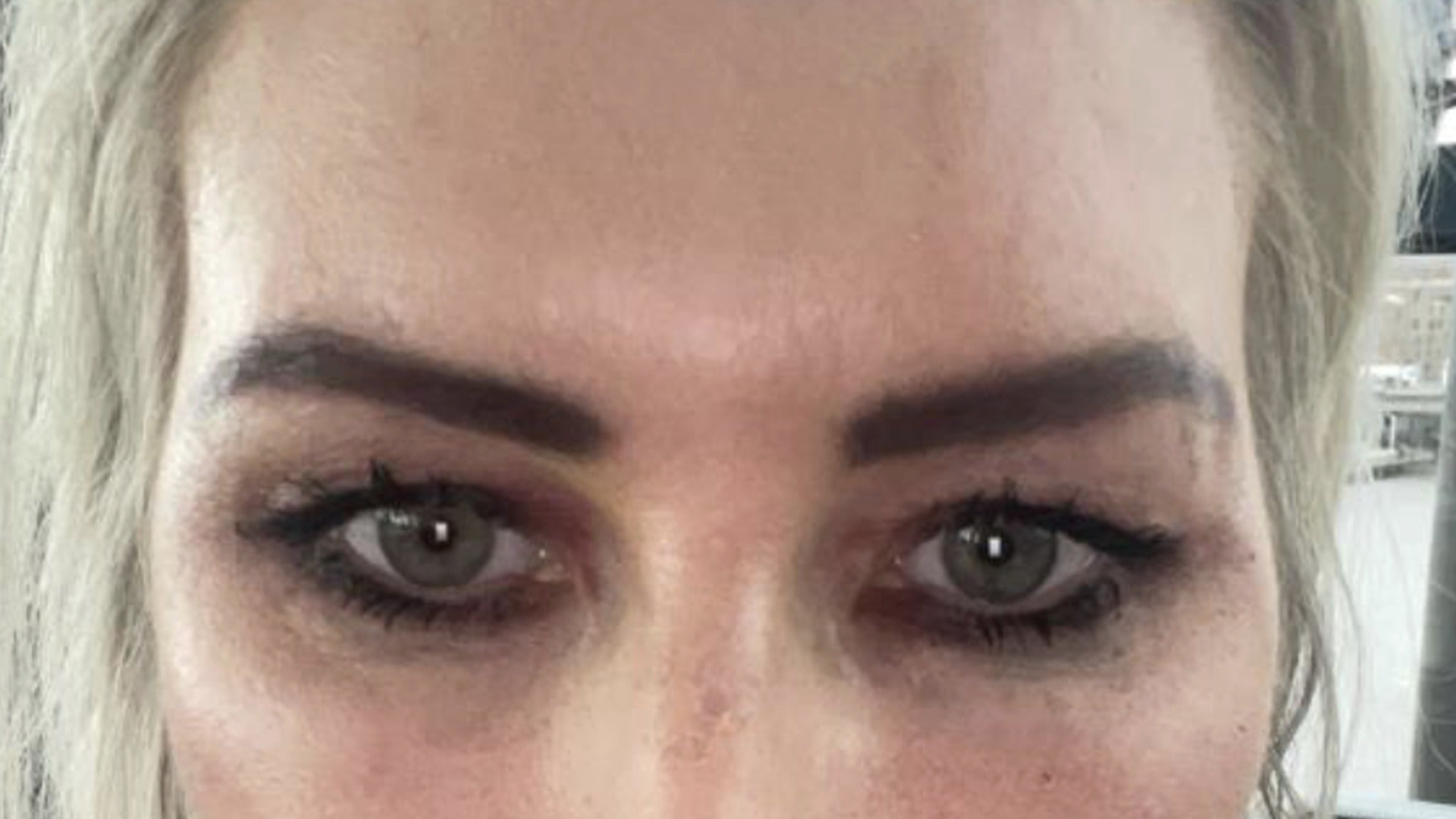 Skin appearance after consistent use of Sculpta
